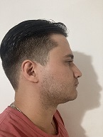 derecha